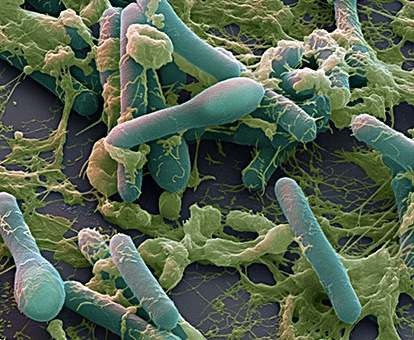 Вбивча інфекція ботулізму Clostridium botulinum